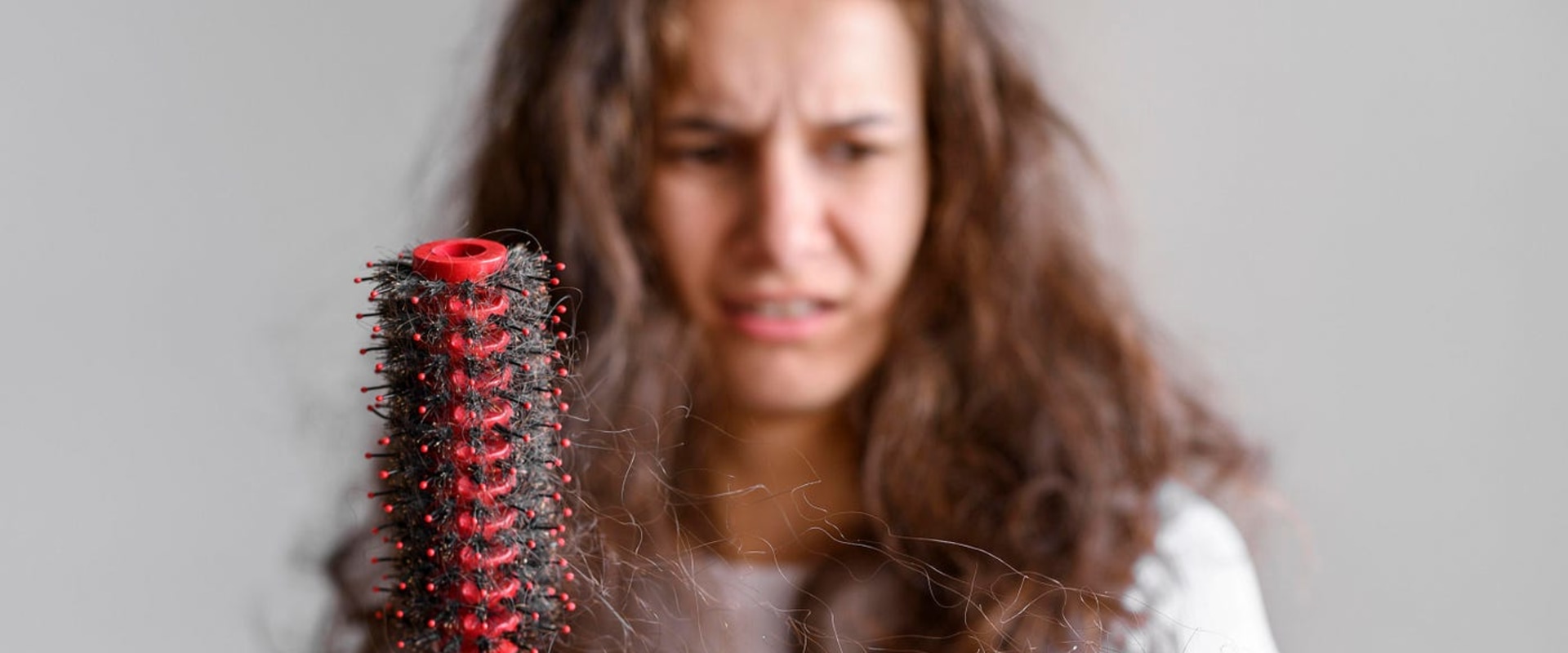Understanding Female Hair Loss: Causes, Prevention, and Treatment